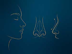 Bolehkah saya membaiki hidung saya selepas beberapa kali gagal?